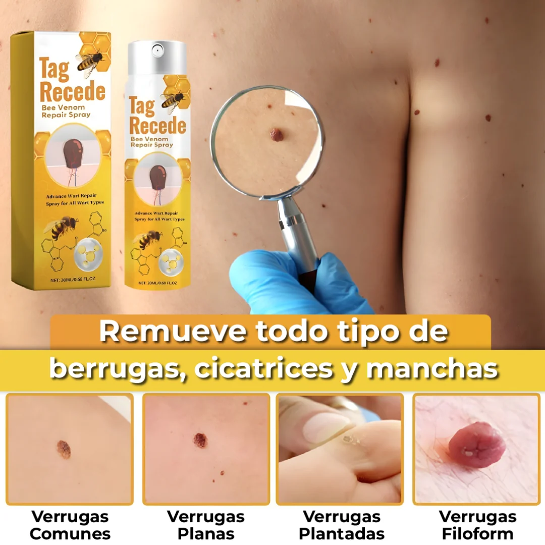 OFERTA 2X1 SPRAY ELIMINADOR DE VERRUGAS - TAG RECEDE