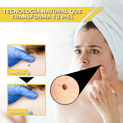 OFERTA 2X1 SPRAY ELIMINADOR DE VERRUGAS - TAG RECEDE
