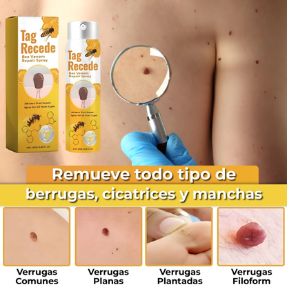 OFERTA 2X1 SPRAY ELIMINADOR DE VERRUGAS - TAG RECEDE